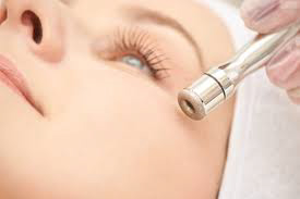 Microdermabrasie